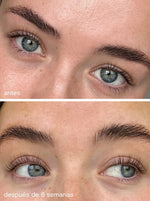 WIOLASH SERUM LASHES
